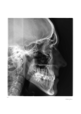 X-ray portrait