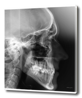 X-ray portrait