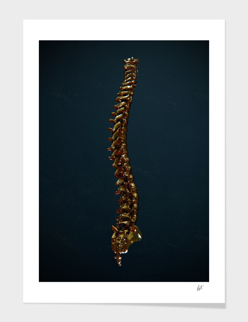 Spinal Goldfection